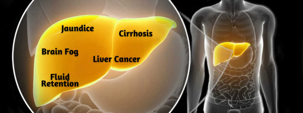 Diagram illustrating the problems related to liver health